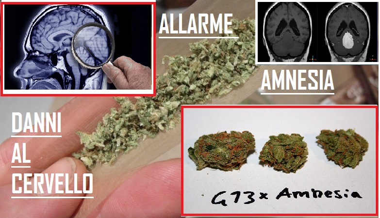amnesia seq
