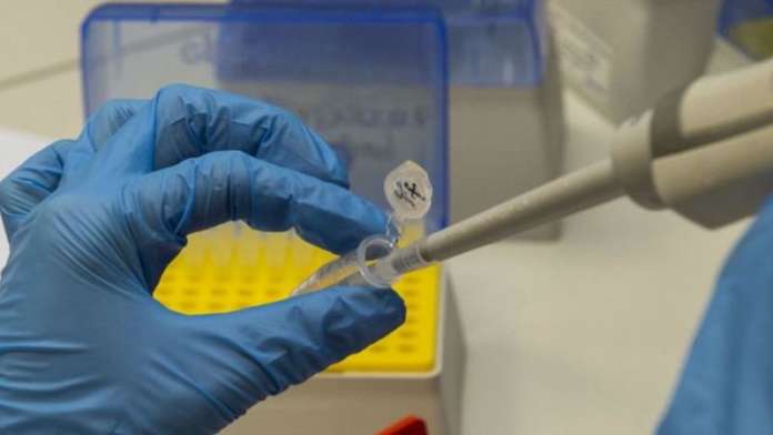 coronavirus positivo 02