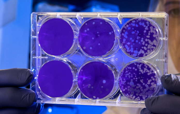 coronavirus tampone positivo 02
