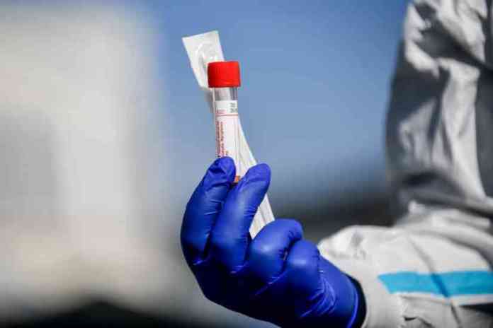 covid tamponi coronavirus 02