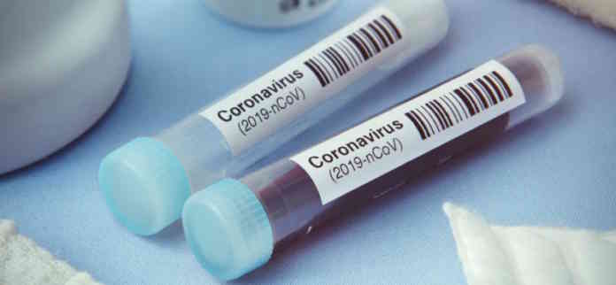 tamponi positivi coronavirus