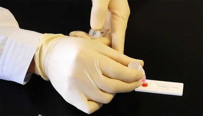 Screening di massa coronavirus