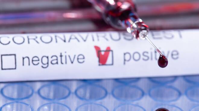 Test sierologici coronavirus 02