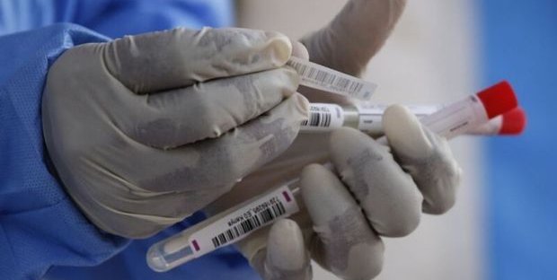 Test sierologici coronavirus 03