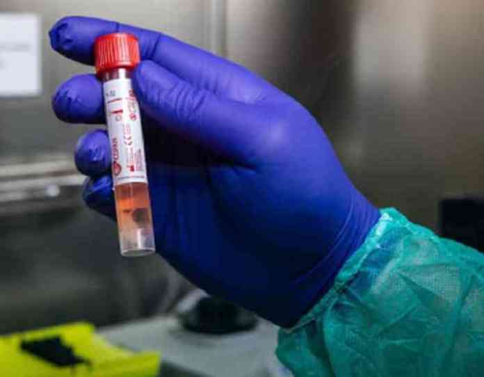 coronavirus-tampone-