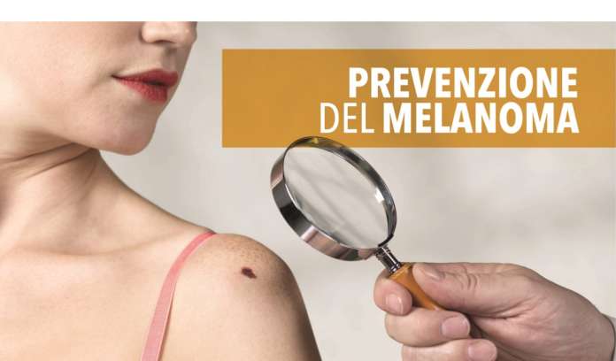prevenzione melanoma