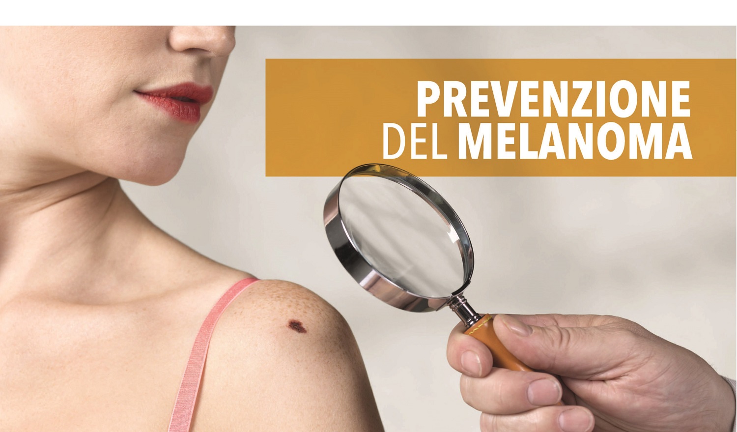 prevenzione melanoma