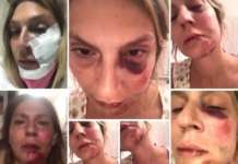 Donna aggredita e percossa mentre è in vacanza in Calabria, quattro arresti nel Napoletano