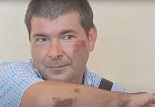 “Un abbraccio a Francesco”, raccolta fondi a sostegno del disabile derubato
