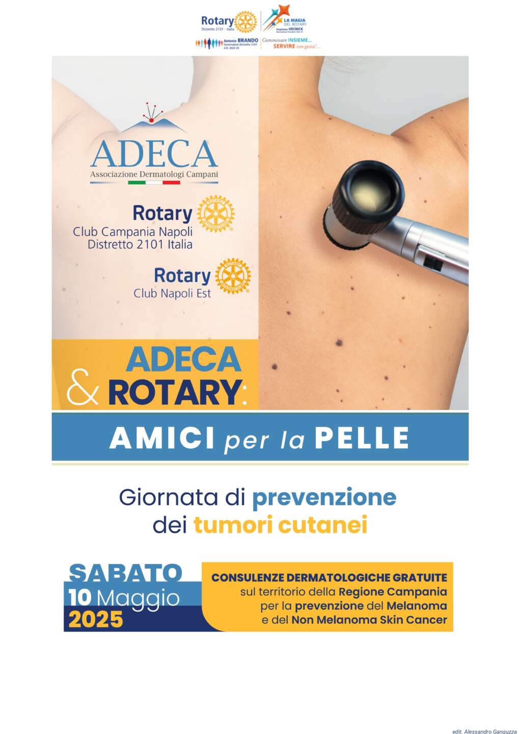 Cancro e prevenzione delle malattie cutanee, a Napoli visite dermatologiche gratuite Cancro e prevenzione delle malattie cutanee, a Napoli visite dermatologiche gratuite