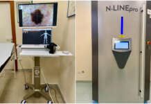 Ospedale San Pio, introdotti il videodermatoscopio e la cabina di fototerapia