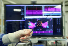 Fibrillazione atriale, al Fatebenefratelli le prime due ablazioni a campo pulsato