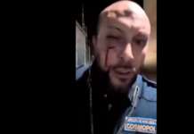 Guardia giurata massacrata di botte per difendere il nuovo treno EAV