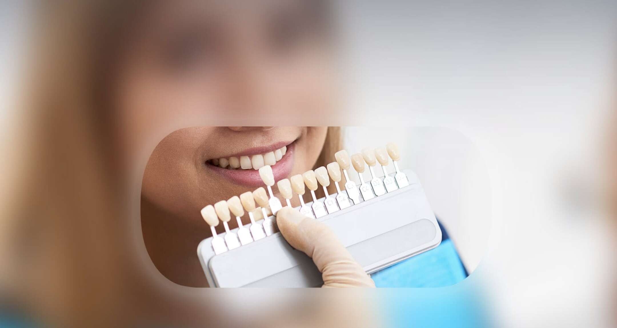 estetica dentale a san pellegrino terme bergamo 232 doloroso rifare tutte le faccette insieme da Anteprima24.it estetica dentale a san pellegrino terme bergamo 232 doloroso rifare tutte le faccette insieme