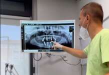 Impianto dentale a Torino: pressione alta e implantologia, cosa sapere prima dell’intervento