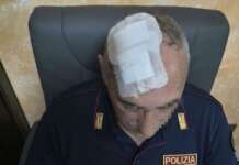 Follia criminale a Saviano: poliziotto ferito alla testa per salvare un cittadino